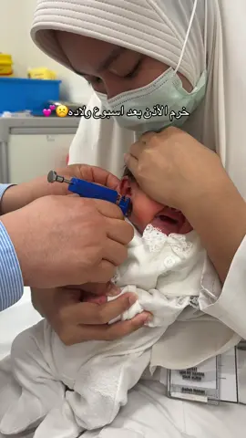 #نونو 