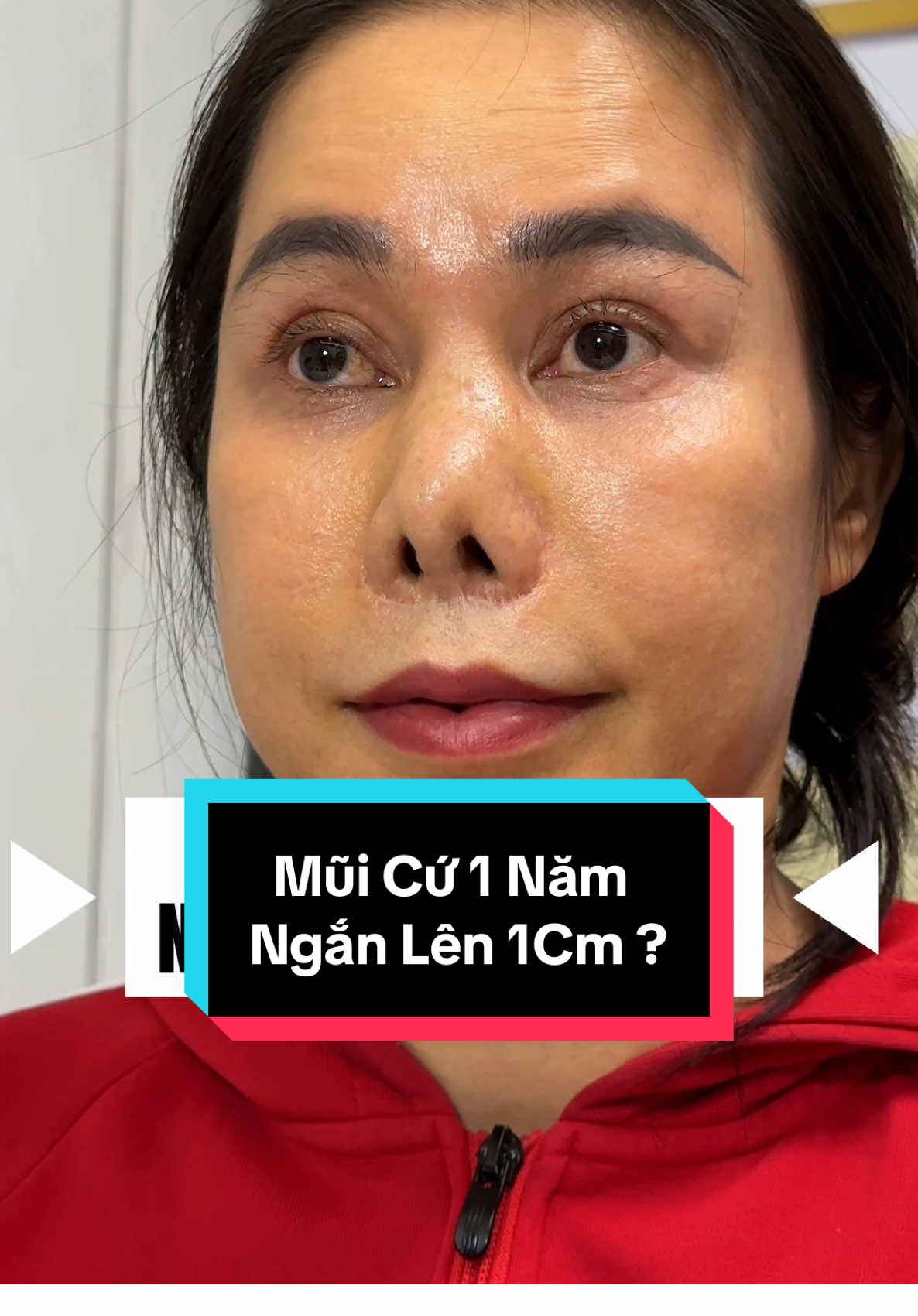 #viralvideo #results #thsbsnguyentienhuy #saigonvenus #ilovetiktok 