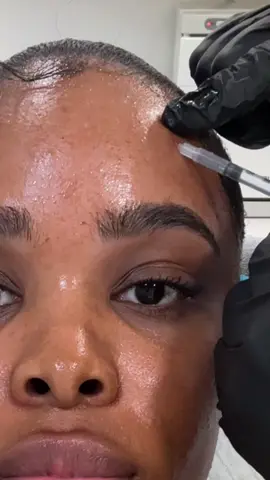 @S.Grimes, FNP 🩺💉 and @joshuaanthonycampbell are Atlanta’s best duo! 🧖🏽‍♀️ @Charette Cosmetics  #CharetteCosmetics @Paul Charette 