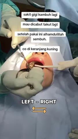 sakit gigi kambuh akar gigi rontok alhamdulillah setelah pakai herbal tetes ini #promomakangajian #gumoraobatsakitgigi #obatsakitgigiampuh #gusibengkak #gratisongkir 