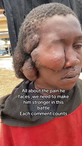 Moses doesn’t have treatment for cancer he needs everything we could