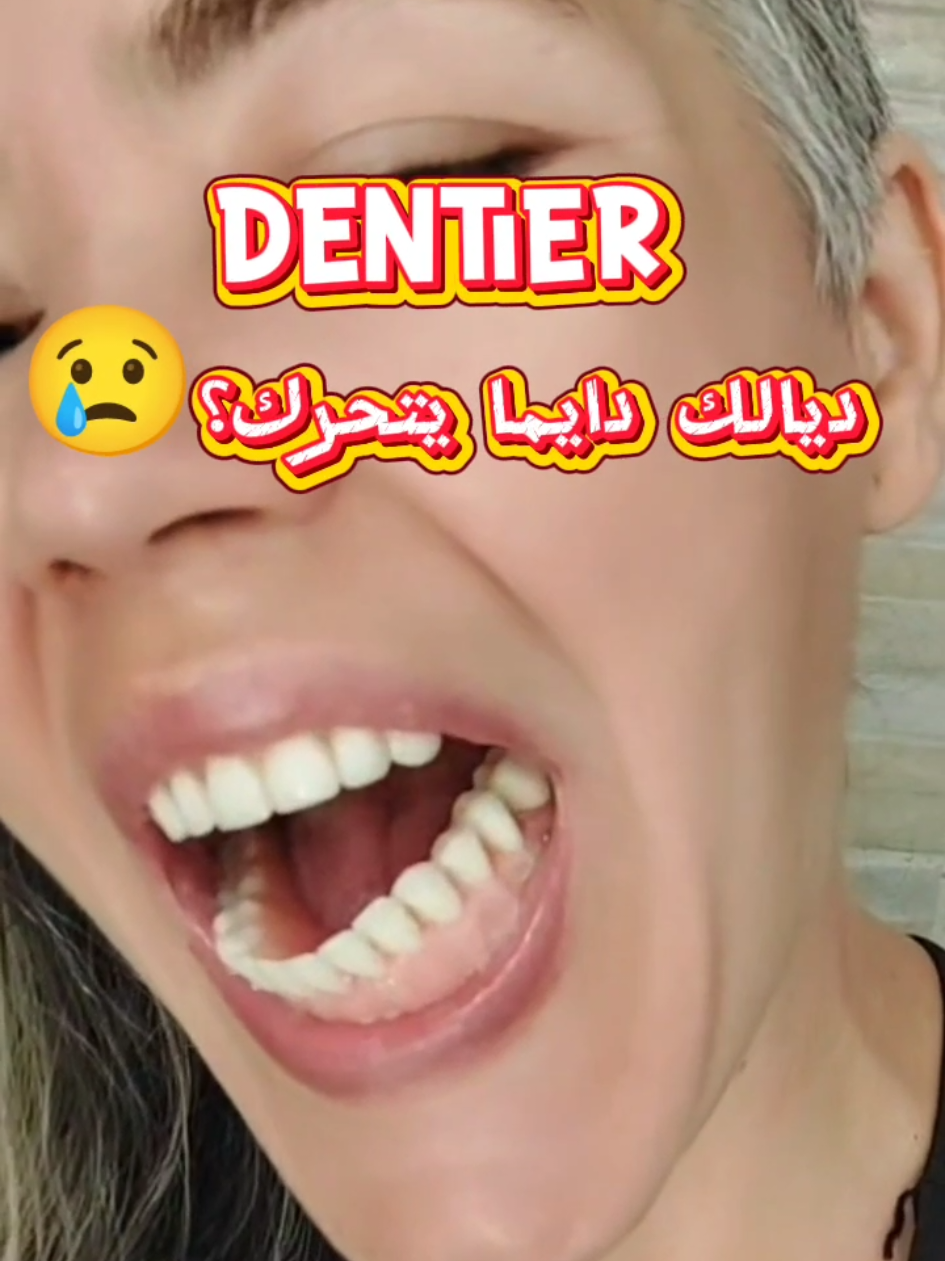 On a la solution pour vous ! ✨🦷 #implants #dentiste #prothese #fyp #viral 