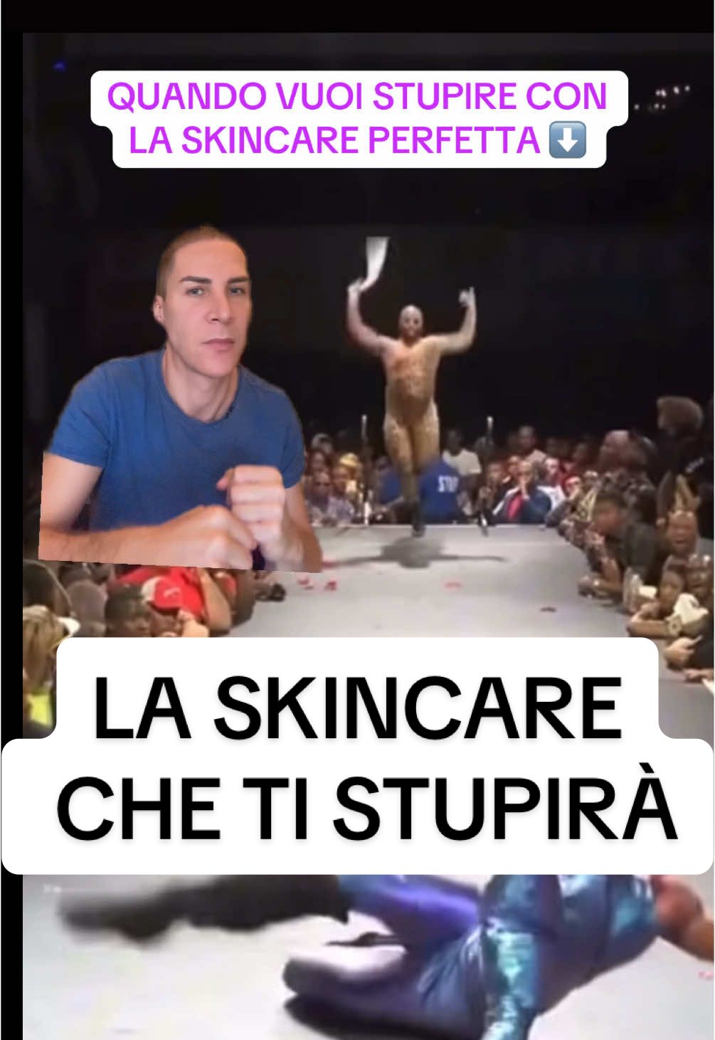 Per una skincare antiage basilare bastano vitamina c, ialuronico e crema idratante al mattino, e retinolo e crema idratante la sera. Ma per avere ancora più cura della pelle e far risaltare la propria bellezza in modo sano è utile sapere quali cosmetici utilizzare in caso di necessità precise: 🌿 Acido salicilico (BHA) Esfoliante chimico liposolubile → penetra nei pori sciogliendo sebo e impurità. Ottimo contro acne, punti neri e pelle grassa. Effetto antinfiammatorio → calma rossori e brufoli. 💧 Acido ialuronico Potente idratante → richiama acqua nello strato cutaneo. Rende la pelle più rimpolpata, elastica e liscia. Adatto a tutti i tipi di pelle, anche sensibili. ✨ Retinolo (vitamina A) Stimola il turnover cellulare e la produzione di collagene. Riduce rughe, linee sottili e macchie scure. Migliora la texture della pelle e la luminosità. Da introdurre gradualmente (può irritare all’inizio). 🍋 Acido glicolico (AHA) Esfoliante chimico idrosolubile → agisce sulla superficie cutanea. Uniforma l’incarnato, riduce macchie e segni post-acne. Stimola collagene ed elasticità. Utile per pelle spenta o con ispessimenti. 🌞 Vitamina C (acido ascorbico e derivati) Potente antiossidante → protegge dai radicali liberi e dall’inquinamento. Illumina la pelle e riduce le discromie. Stimola la sintesi di collagene. Spesso usata al mattino sotto la protezione solare. 🔬 Melasyl  Agisce sulla sovrapproduzione di melanina, bloccando la formazione eccessiva di pigmento. Aiuta a ridurre macchie solari, melasma e discromie persistenti. Più delicato di altri schiarenti (es. idrochinone). 🧴 Zinco piritione Proprietà antimicrobiche e antifungine. Usato contro dermatite seborroica, forfora e acne. Aiuta a regolare la proliferazione di funghi/batteri sulla pelle. #bellezza #skincare #medicinaesteticamadrid #curadellapelle   