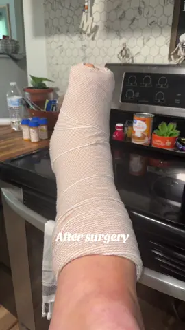 #surgerytiktok#footsurgeryrecovery#fypシ゚viral#fypシ #surgery 