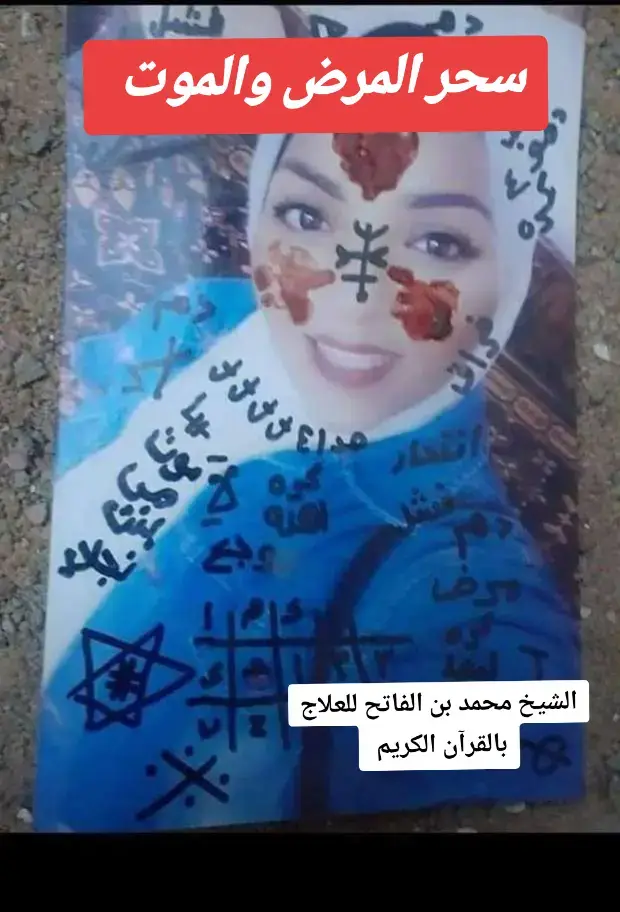 أعراض سحر المرض والموت من أهم أعراض سحر المرض والموت يصاب الشخص بالمسحور بحالة من الضعف العام وعدم المقدرة على فعل أي شيء. ومن أعراض سحر المرض حتى الموت الشعور بالصداع المستمر بالرأس لا ينتهي بالعلاج. يكون من أعراض سحر التمريض أو أعراض سحر القتل للملاعب مرض مستعصي. حالة من ضيق في الصدر يصاحبها صعوبة في التنفس. الإحساس بألم حاد في الظهر وعضلات الجسم كافة يعد من أعراض السحر بالمرض. يحدث له نوبات مشابهة لنوبات الصرع. حالة من الشرود والتوهان والنسيان من أعراض سحر المرض حتى الموت أو أعراض السحر عمومًا. للملاعب بحالة نفسية سيئة واكتئاب دون سبب والبكا بلا مبرر. عند المرأة، فقد يحدث لها حالة من سقوط الشعر بشكل غريب دون سبب طبي ولا يستجيب للأدوية. يميل لحالة العزلة والوحدة والبعد عن الناس واعتزالهم. إصابات شديدة في النوم يصاحبها بعض الكوابيس المزعجة. أثناء النوم أو اليقظة يتخيل سماع صوت بكاء ومن أعراض سحر القتل شعور المريض بإيذاء نفسه واحساسه انه يريد الانتحار... نسأل الله السلامة والعافية #الخليج_العربي_اردن_عمان_مصر_تونس_المغرب #creatorsearchinsights #البحرين🇧🇭قطر🇶🇦الكويت🇰🇼عمان🇴🇲 #الكويت_مصر_السعودية_سوريا_الامارت #السعوديه_الكويت_الامارات_قطر_عمان_البحرين_اليمن 