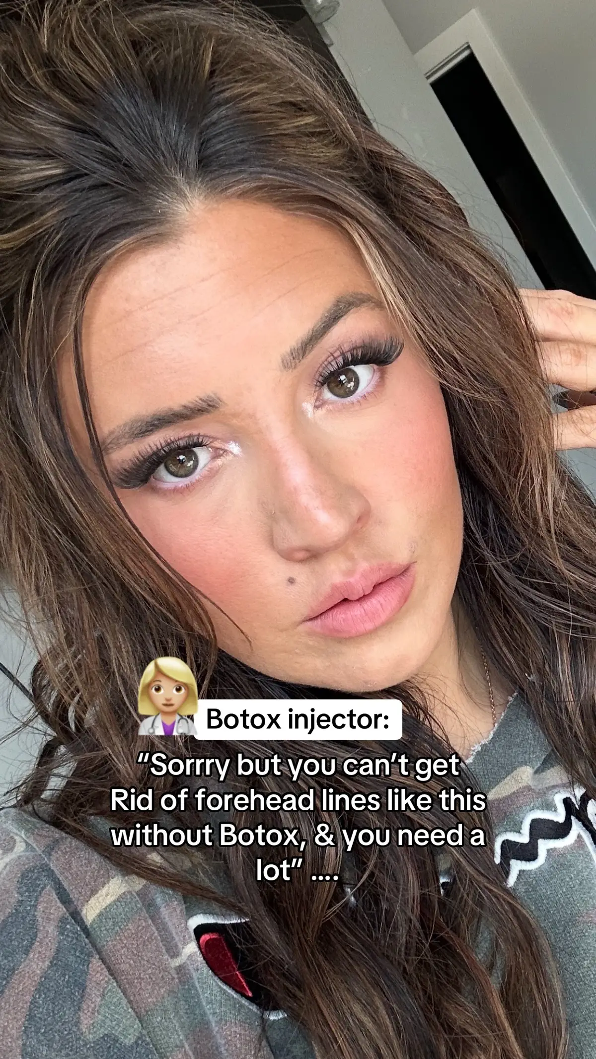 #frownies #botoxalternatives #frowniesresults #frownieswrinklepatch #frowniesfacialpatches 