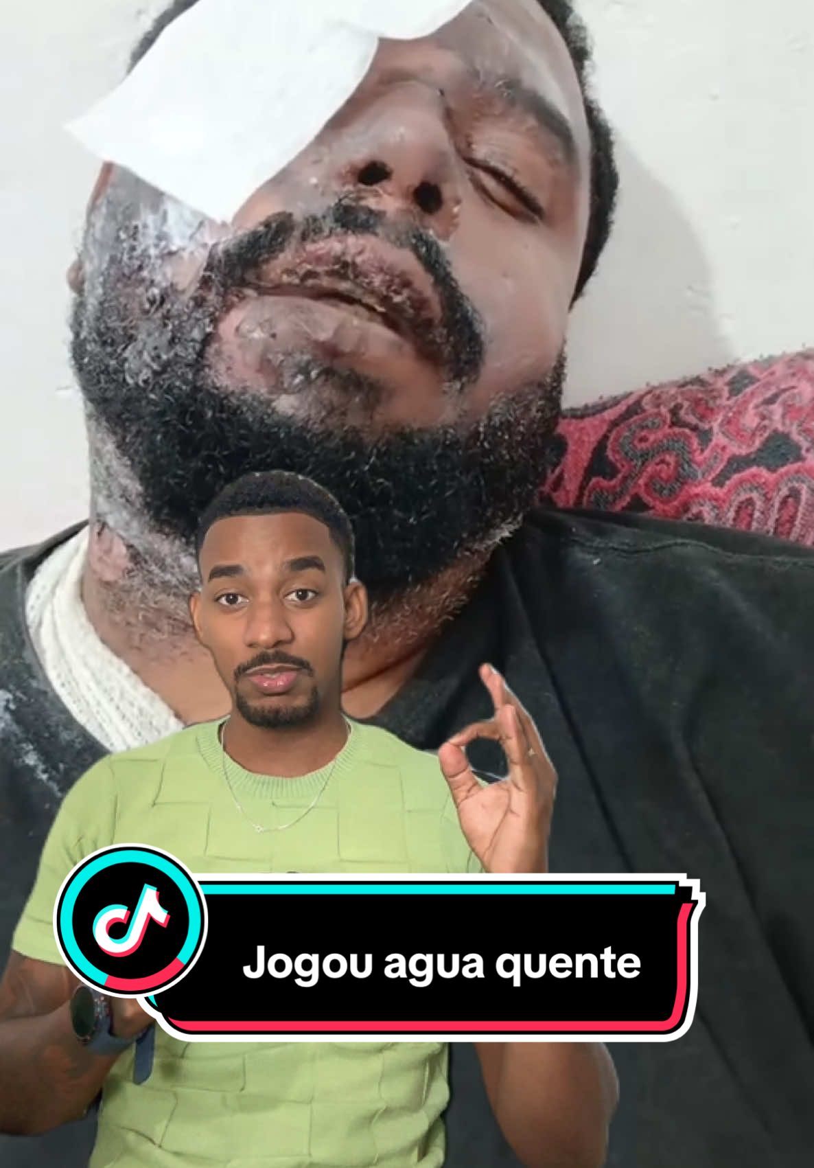 Mulher jogou água quente em quanto ele dormia.. @Milagre de Deus #mulher #traição 