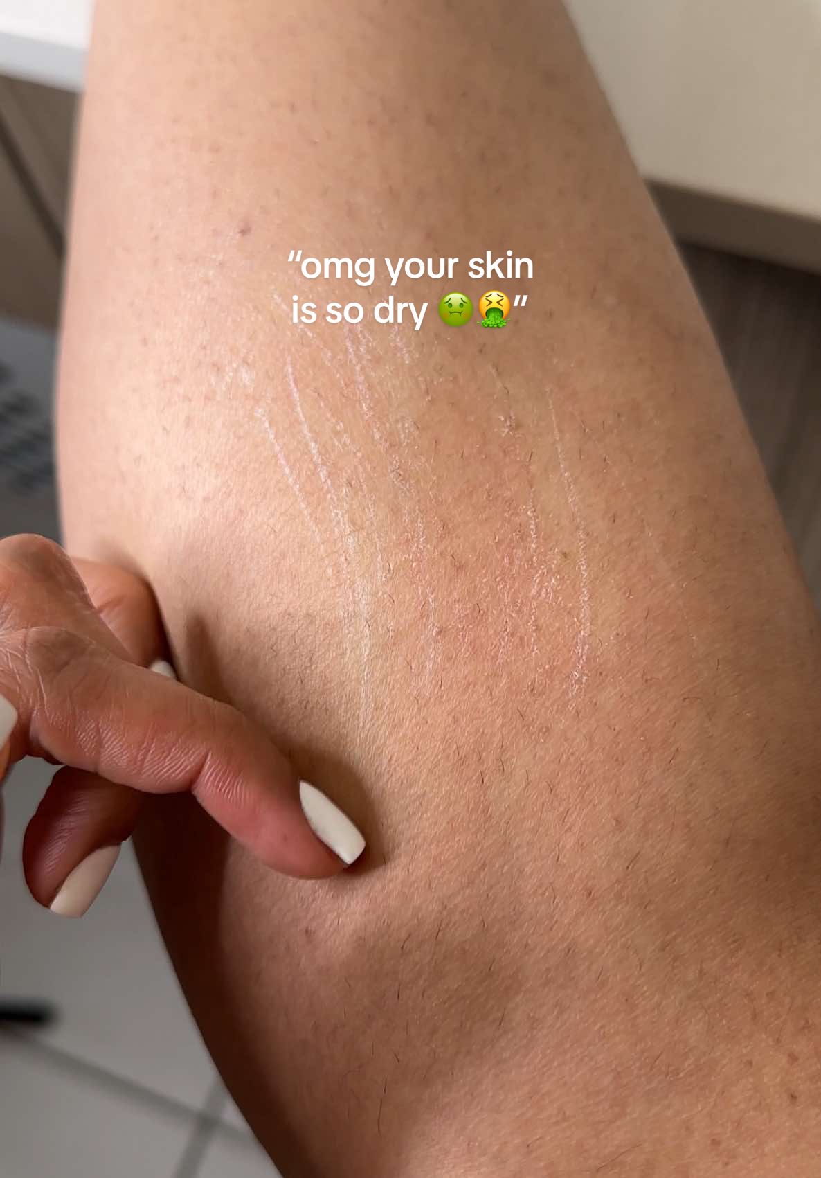 #COSRXPartner | I DONT PLAY when it comes to my body care routine and my skin is proof of that 🤭 (it has come a long way 😅)  So trust when I say that this Skin Barrier Moisturizing Cream NEEDS to be in everyone’s skincare routine.  Dry skin ages you way faster than wrinkles and it worsened my stubborn skin issues: strawberry skin, ingrown hairs and hyperpigmentation. Your body deserves the same love as your face and when you give it that, the difference is UNREAL ✨ @COSRX Official  #COSRX #KoreanBodyCare #BodySkinBarrierCream #BodyCream 