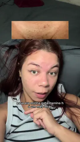 #cuidadoscomapele #mulheres 