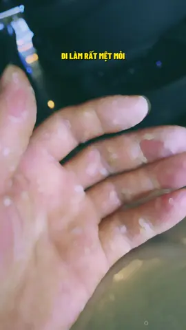 #CapCut 🥺🥺🥺🥺🥺🫣🥹😢😓#xuhuongtiktok mệt quá rồi 🥺🥺🥹🥹