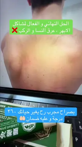 #الابهر #الظهر #عرق_النسا #المفاصل 