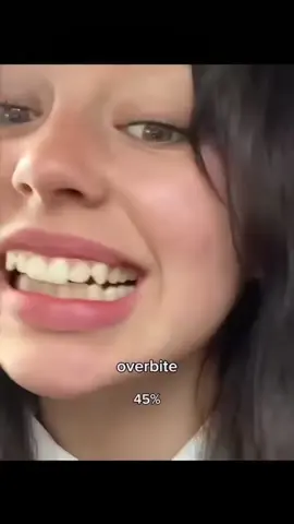 #stitch with @The Glowifyx IM HAUNTED BY THIS #overbite 