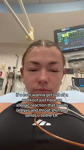 jk guys I DONT recommend (this was obviously not on purpose lol) #allergicreaction #allergies #athletes #workout #athlete 
