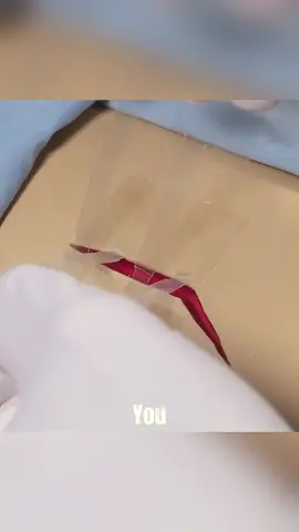 The Tape That Replace Stitches #DidYouKnow #education #knowledge #fastforwardlife #tecnology 