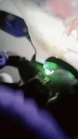 dikatain sepele,sama yang lebih sepele🤏🏼 #bismilahfyp #story 