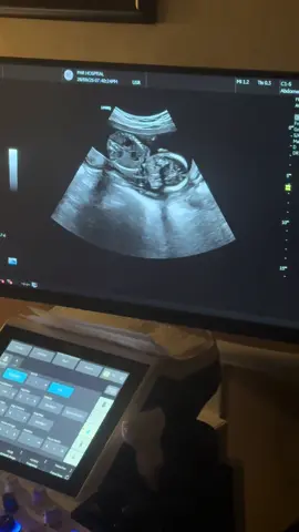 ماعرف شنو احجي او شنو اعبر بس احلى شي صار بحياتي من بعد حبي لزوجي وهديه ربي الي رزقني بانسان زرع بداخلي الحب والحنيه  انطاني احلى ثمره حب  راد يعيد الحب الي بيناتنه بطفل يترس حياتي  انتضره بفارغ الصبر الله يتمم ع خير ويحفظ الي ابو يوسف زوجي الغالي وابني ❤️