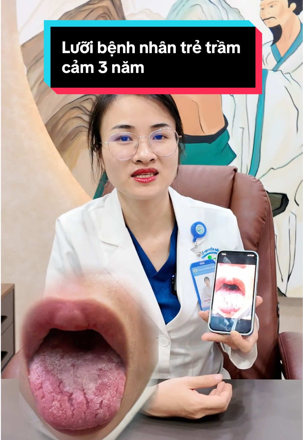 Lưỡi của bệnh nhân trầm cảm 3 năm sẽ như thế nào? #matngu #roiloanloau #tramcam #fyp #LearnOnTikTok 