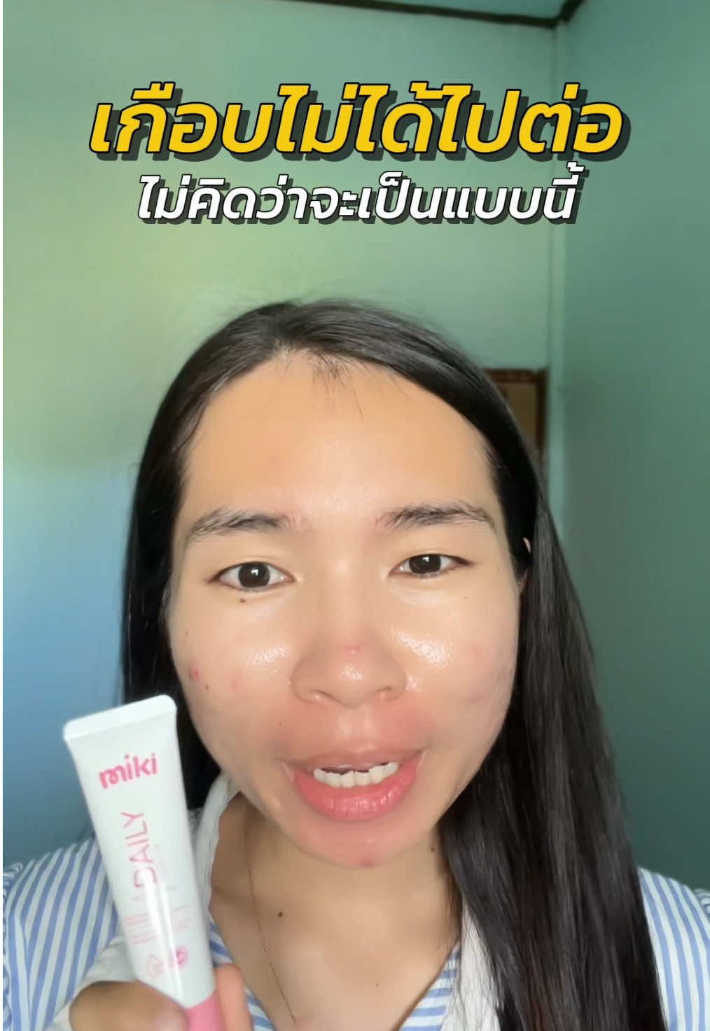 ก็ไม่คิดว่าจะขนาดนี้เหมือนกัน #มิกิเข้าใจผู้หญิง #เซรั่มมิกิ #miki #เรตินอลจุดซ่อนเร้น 