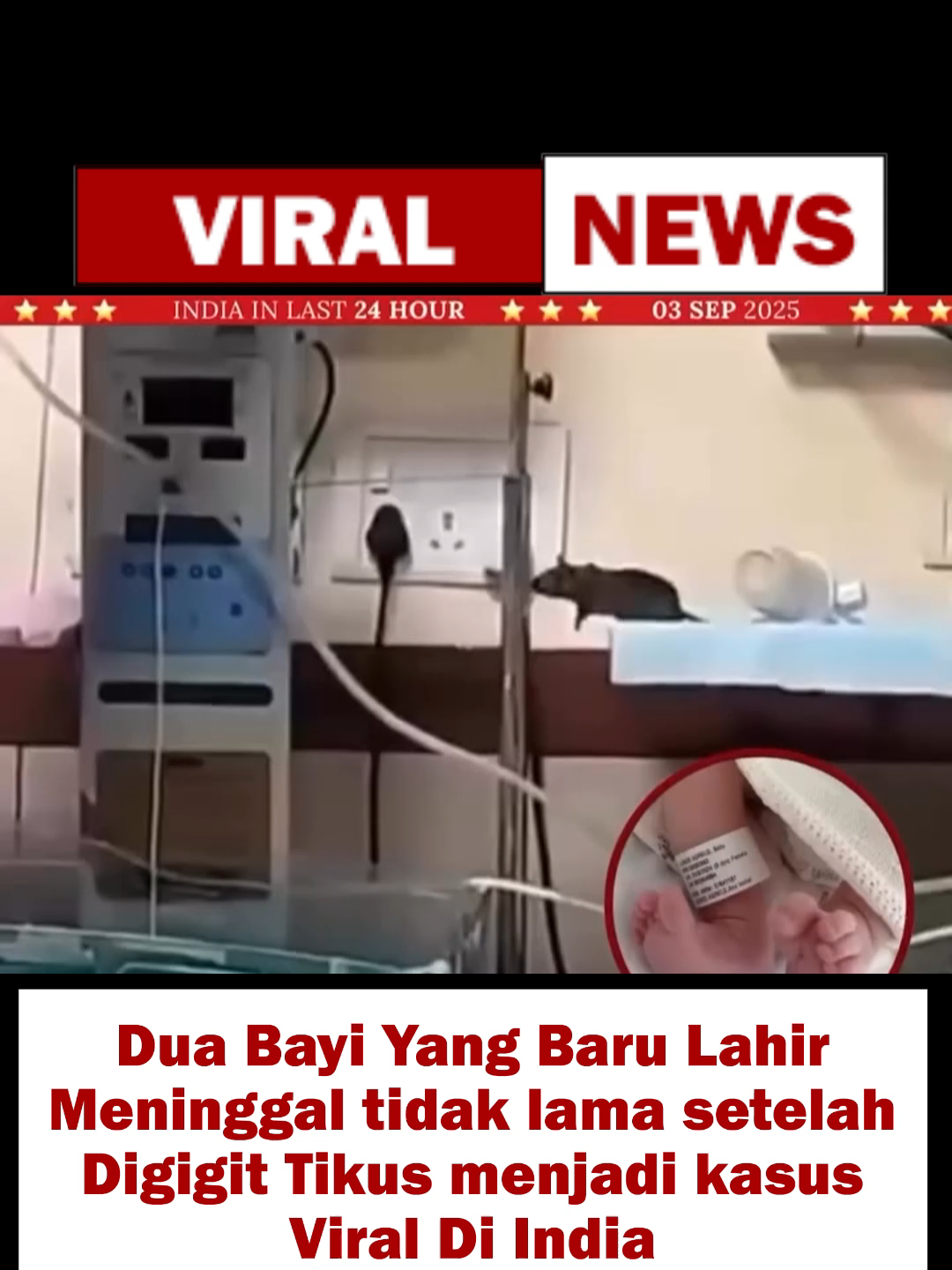 Dua Bayi baru lahir digigit oleh tikus yang bisa masuk ke ruangan NICU “HARUSNYA STERIL” meninggal pada hari Selasa (02-09-25) dan satu lagi di hari Rabu (03-09-25) Kejadian ini terjadi pada salah satu RS Terbesar milik Pemerintah India yaitu RS Maharaja Yeshwant Rao.  Buntut dari kejadian ini adalah beritanya menjadi VIRAL di Sosial Media!!! Pihak RS mengakui ada kelalaian dalam sterilisasi sampai tikus bisa masuk, tapi pihak RS menganggap kematian ke-2 Bayi tersebut karena keadaan Prematur saat lahir dengan BB di bawah normal, Anemia, Usus dan berbagai Organ yang belum dengan terbentuk sempurna.  Pihak RS menganggap kejadian pada ke-2 Bayi ini meninggal bukan dikarenakan gigitan tikus walau ditemukan luka gigitan pada kepala dan kedua jari bayi.  (NICU : Seperti ruangan ICU tapi khusus untuk bayi baru lahir 0-28hari yang memerlukan perhatian khusus) #india #beritaviral #indonesia #viral