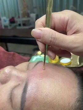 Diện chẩn giảm đau đầu mất ngủ-bài hàn-giải cảm ✅tớ có cả khoá hc tt và ol nha các nàng❤️