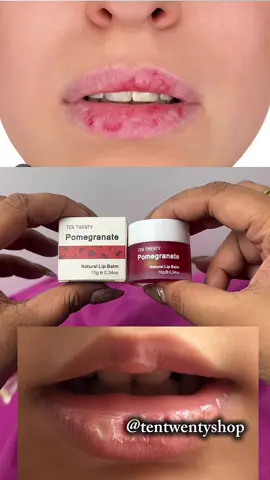 No more dry lips,dahil sa pomegranate lip balm na to🥰🩷 #tentwenty #lipbalm #pomegranate #drylips #chappedlips 