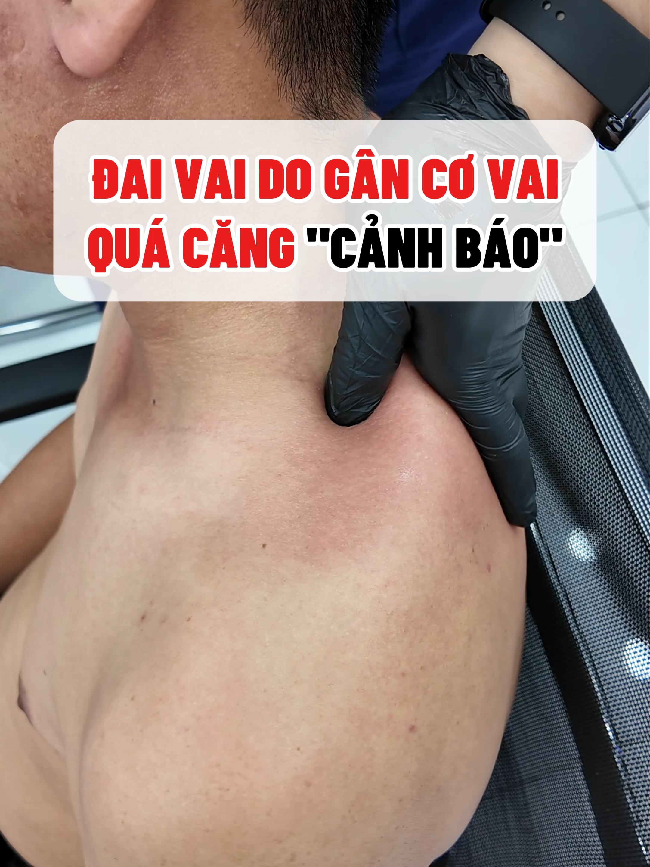 đau vai cho gân cơ vai quá căng, cảnh báo nguy hểm #xuhuong #tintam #dauvai #suckhoe