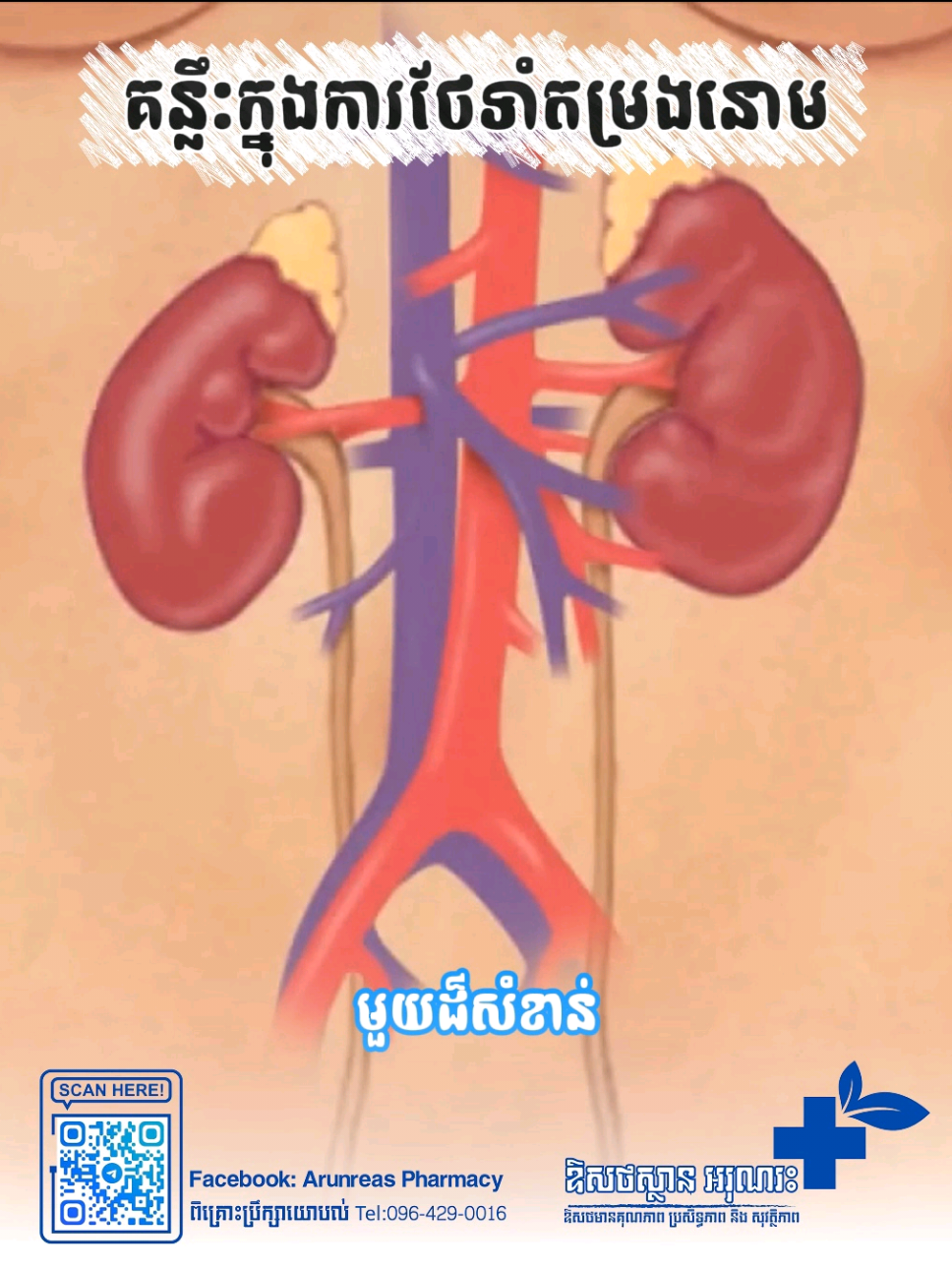 ✅ គន្លឹះថែរក្សាតម្រងនោម៖ _ផឹកទឹកឱ្យគ្រប់គ្រាន់ -កាត់បន្ថយអាហារសំបូរប្រេង អំបិល និងជាតិចម្រាញ់ -បរិភោគផ្លែឈើ បន្លែស្រស់ និងអាហារសម្បូរទឹក -ប្រើ Cystone ដើម្បីជួយការពារការបង្កើតថ្មតម្រងនោម និងថែរក្សាសុខភាពតម្រងនោម 🌿 Cystone ជាឱសថបុរាណអាយុវេទ ផលិតពីរុក្ខជាតិធម្មជាតិ ដែលមានប្រយោជន៍ក្នុង៖ ✔️ ជួយបង្ការការកើតឡើងវិញនៃថ្មតម្រងនោម ✔️ ជួយបំបែកថ្មតូចៗក្នុងតម្រងនោម ✔️ ជួយបន្ថយការឈឺចាប់ពេលបញ្ចេញទឹកនោម ✔️ គាំទ្រប្រព័ន្ធនោម និងជួយបង្ហូរទឹកនោមបានប្រសើរឡើង ✅ព្រឹក្សាពិគ្រោះយោបល់ទាក់ទងនឹងឱសថជាមួយឱសថការីជំនាញ នៅឱសថស្ថានអរុណរះ  #arunreaspharmacy #Healthy #Kidneys #Naturally #cystone    