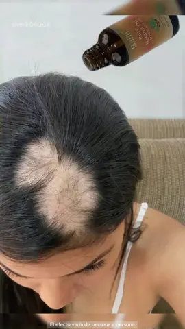 'El champu que me recomendó mi amigo doctor es realmente bueno. Si sufres de una fuerte caída del cabello,¡tienes que probarlo!