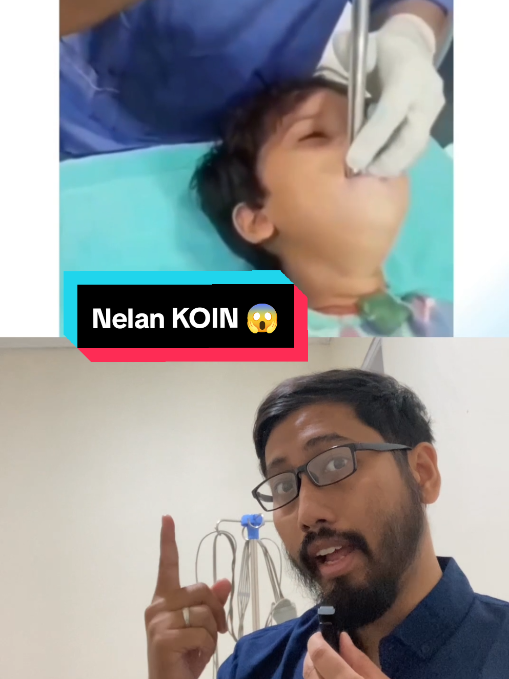 Akibat NELAN KOIN ⁉️#faktaunik #faktakesehatan #faktaunik 