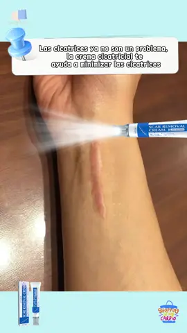 Targeted fading, remarkable results. Scar Cream makes beauty a reality. #TargetedFading #RemarkableResults