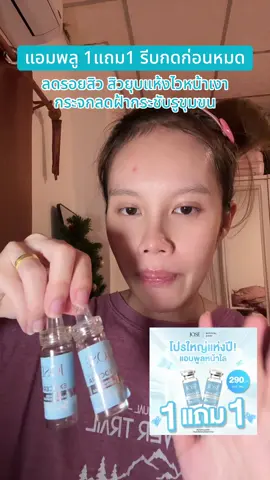 #รีวิวบิวตี้ #รีวิวโจเซ่ #ครีมโจเซ่ #แอมพลูโจเซ่ #ลดรอยสิว 