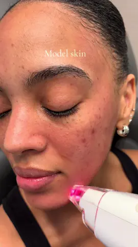 Gimme that glow #skin 