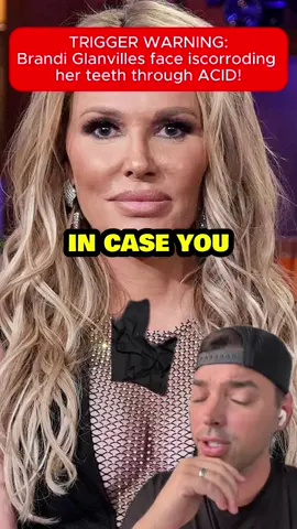 TRIGGER WARNING: Brandi Glanvilles face is corroding her teeth through ACID! #bravotv #rhobh #realhousewivesofbeverlyhills #brandiglanville #kylerichards #isavanderpump #teddimellencamp