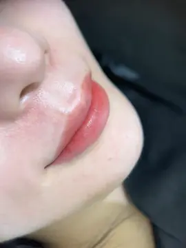 Chị bé thích lòng màu xí muội đậm hơn bên ngoài một tí #phunmoidep #khuthammoitunhien #moidephanoi #phunmoikhongdau #phunmoihoangmai 