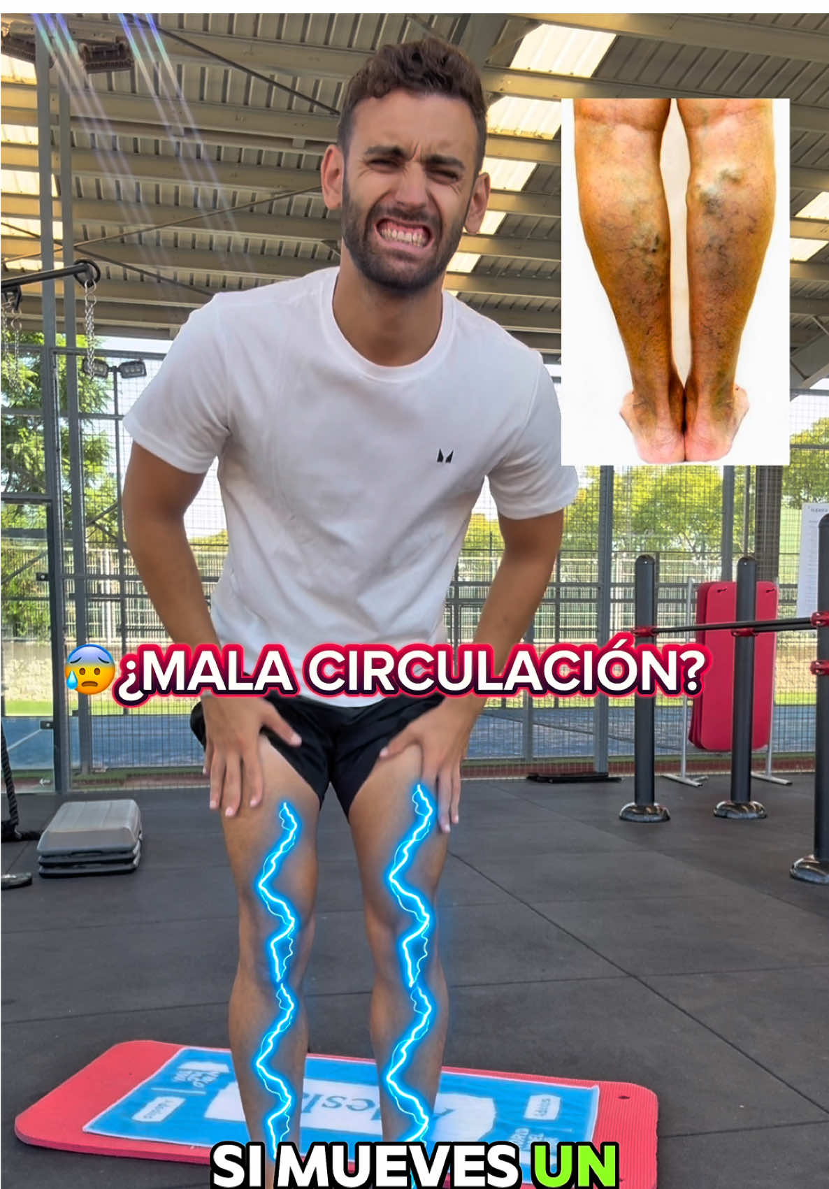 😰¿Tienes mala circulación en las piernas, hinchazón o empiezas a notar varices? 🦵 En este video te muestro 4 ejercicios fáciles que puedes hacer en casa, sin equipo, para mejorar la circulación, aliviar la pesadez y reducir el riesgo de varices. Beneficios de esta rutina: ✅ Activa el retorno venoso ✅ Reduce la hinchazón y el dolor de piernas cansadas ✅ Ayuda a prevenir varices ✅ Ejercicios simples y rápidos en casa 📌 Guarda este video y compártelo con quien necesite mejorar la circulación de sus piernas  💬 ¿Quieres que suba una rutina completa de 5 minutos para piernas ligeras? Comenta: PIERNAS 🦵  #circulacion #varices #piernascansadas #rutinafacil #adrifisiofitness 