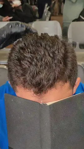 باور نکردنیه ولی واقعیت داره😍🥰🥰🥰 #haircare   #hairgrowth   #herbalremedy   #naturalbeauty   #hairlosssolution