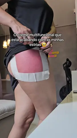 O creme que está acabando com as minhas estrias #estrias #estriasbrancas #cremerosa #adeus #creme 