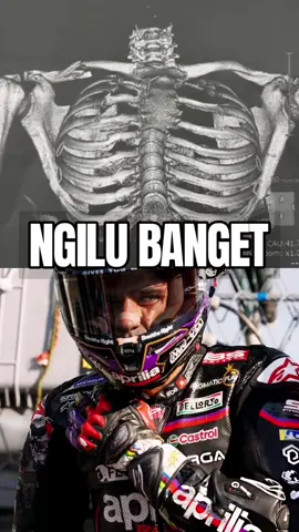 Kondisi Tulang Jorge Martin Setelah Crash di Motegi #jorgemartin #japanesegp #beritamotogp #martin 