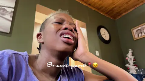 Mind you I just woke up from a nap! What is this?😔👍 do I deserve to be in so much pain!😭😭😭 Kopa pilers! #fyp #braces #pain #funny #viral 