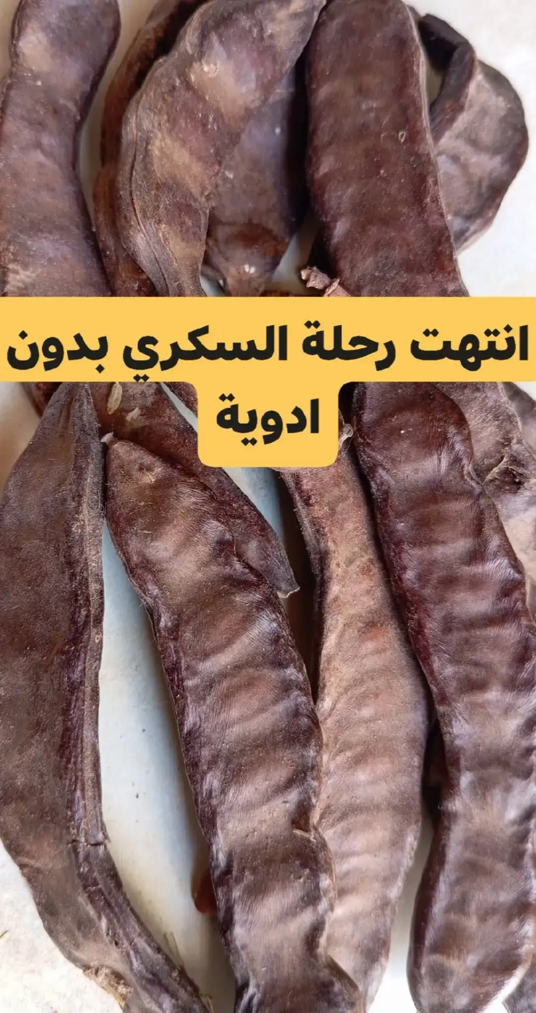 #انتهت رحلة السكري دون أدوية! 🌟 مريض سكري يروي تجربته الناجحة في التحكم في السكري لمدة 4 سنوات دون أدوية. إليك البرنامج الذي اتبعه: - المشي يوميًا لمدة ساعة - شرب القرفة يوميًا - شرب مغلي أوراق الزيتون كل صباح - تناول الحلبة المنقوعة قبل الوجبات - إضافة الكركم إلى الطعام والماء - اتباع نظام غذائي منخفض السكر والكربوهيدرات - مراقبة دورية للسكر والتراكمي النتيجة كانت مذهلة: انتظام السكر في الد.م بعد 3 أشهر، وانخفاض تدريجي في التراكمي حتى أصبح طبيعيًا بعد سنة. استمر هذا النمط الصحي لمدة 4 سنوات دون أدوية. جرب هذه النصائح واستمتع بالصحة والعافية!  اذا أتممت القراءة صل على النبي 💜💜#⚫👈وصفة #