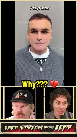 We call this “The Clothespins Behind The Head” Special! To watch full episodes of the Last Stream on the Left, check out our YouTube channel or watch it LIVE every Tuesday at 6pm pst/9pm est by becoming a member of our Patreon, links in bio!  