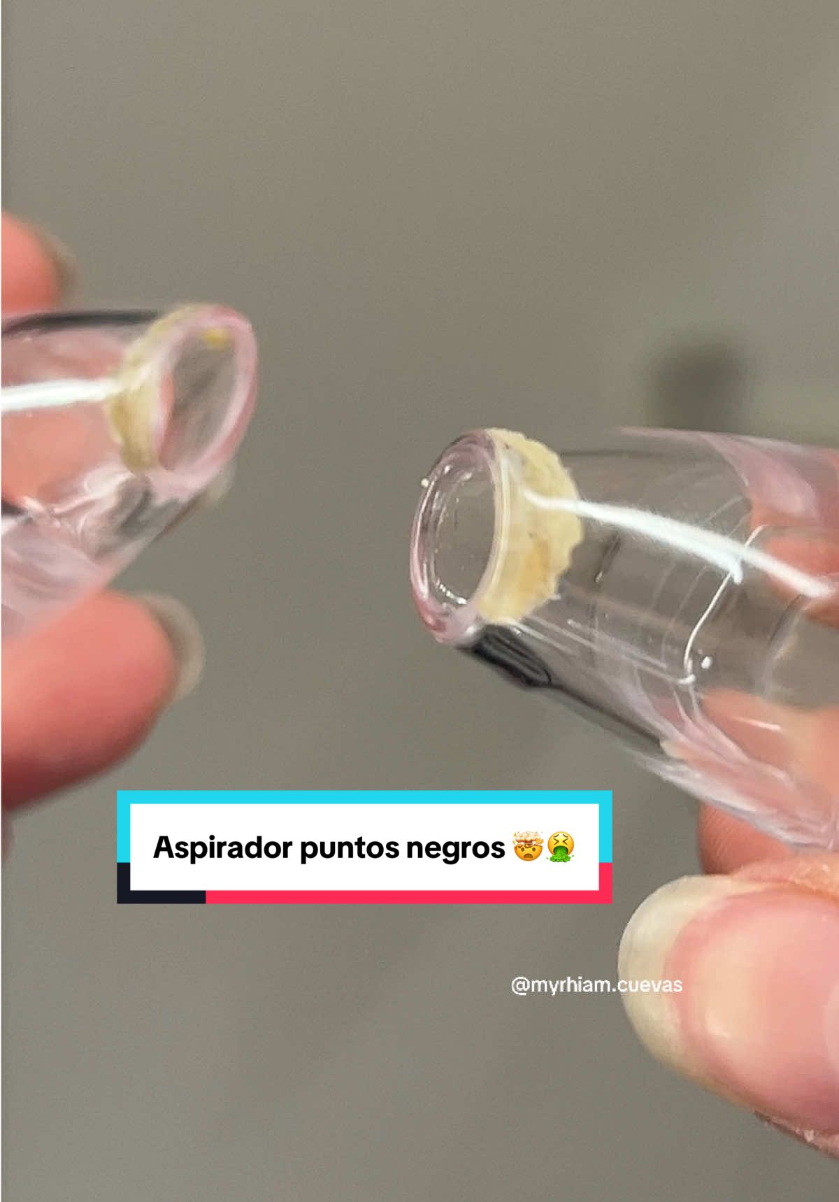 Si súper funciona! Está fue la segunda vez usando el aspirador de puntos negros 🤌🏻 amo esta cosa jajajaja  Ahora les puedo confirmar que si sigue las instrucciones no te vas a dejar roja la cara 😳🤣😩 #puntosnegros #limpiezafacialprofunda #encasa #ventaquincenal #vamostiktokshop 