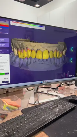 #fyp #exocad #dentallaboratory #f #fyppp 