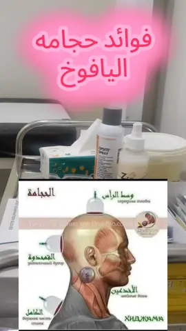 #اكسبلور_تيك_توك #ccreatorsearchinsights #الحجامة_الطبية  فواىد موضع اليافوخ بالحجامه