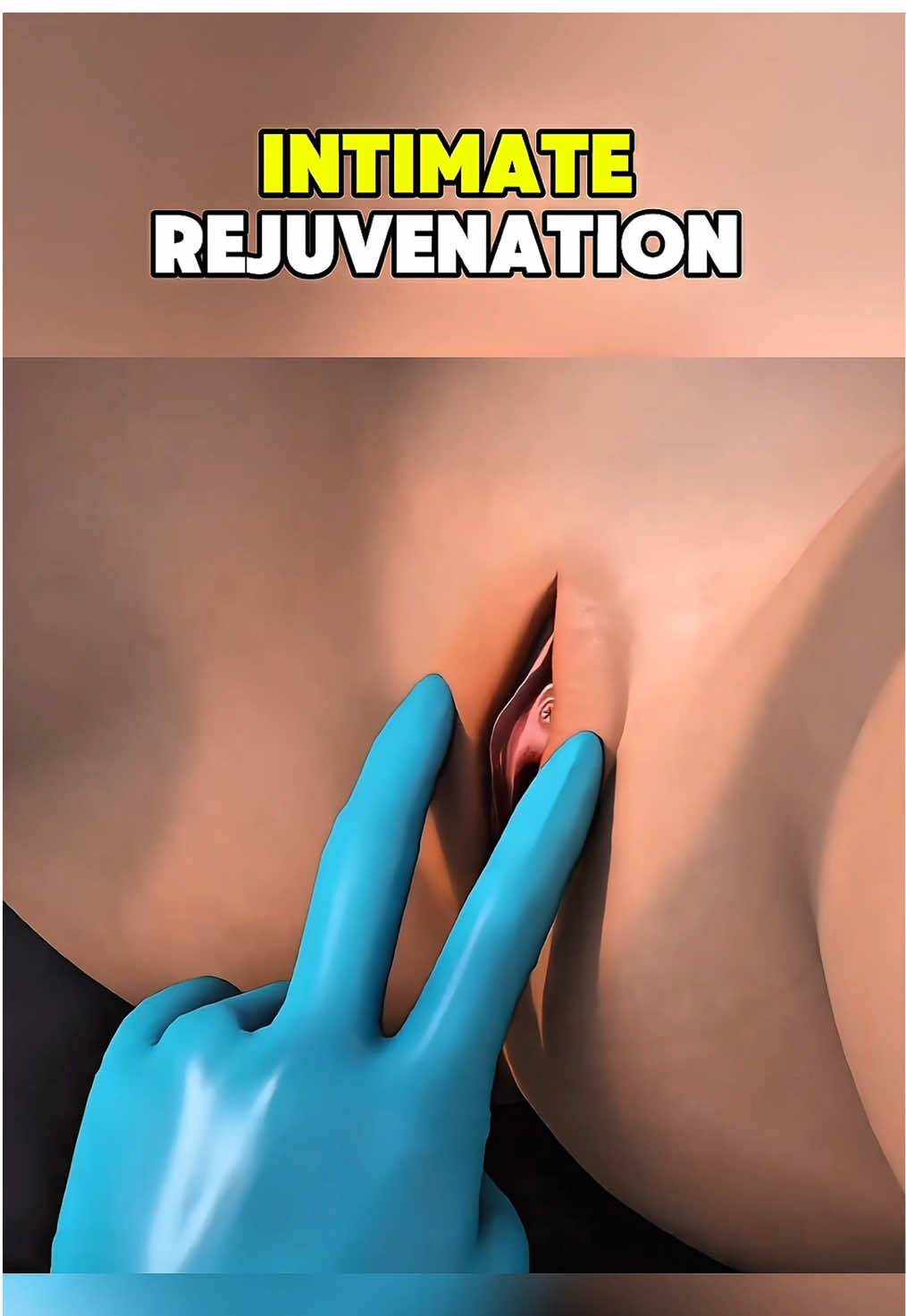 |Ever wondered how intimate rejuvenation helps to improve the look,feel and function of the intimate areas?| #WellnessJourney #SelfCare #HealthyLifestyle #BeautyAndHealth #ConfidenceBoost   