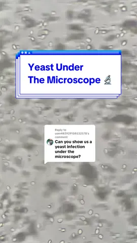 Replying to @user483929108532578 Yeast under the microscope 🔬 #Science #microscope #fentysuperbrandday #yeast #echorebel 