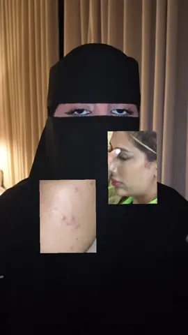 اسهل من كذا مافيه🫡 @فانير ad