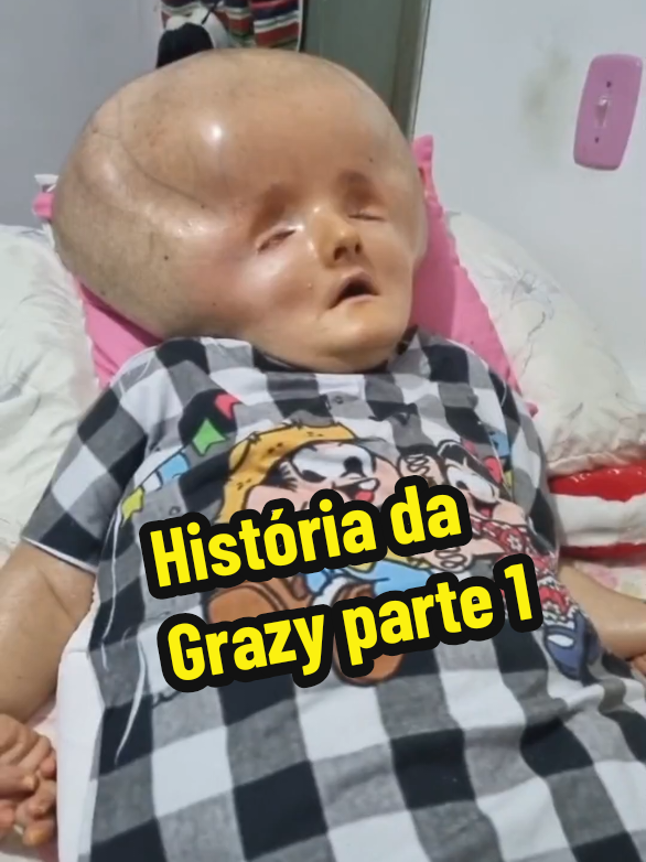 História da Grazy parte 1 #fyppppppppppppppppppppppp #hidrocefalia #viral 