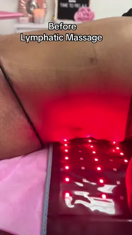 #modesto #bodysculpting #lymphaticmassage