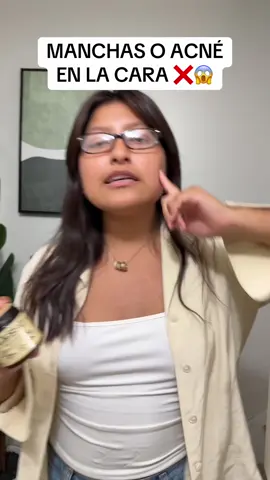 CREMA PARA ACNÉ Y MANCHAS ❌ #ceboderes #barrosyespinillas 